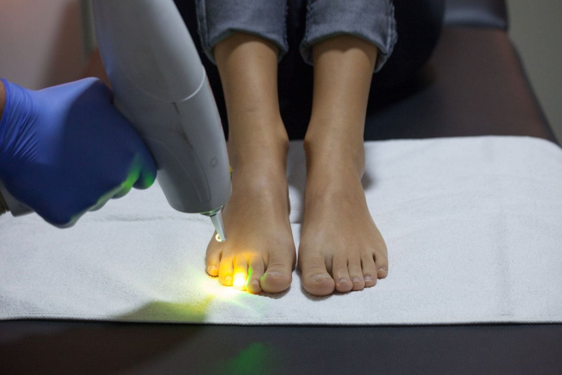 Types Of Laser Nail Fungus Treatment - Which Treatment is More Effective?